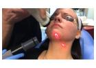 Laser For Acne Scars Orlando