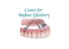 Center For Implant Dentistry