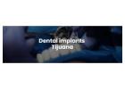 Dental implants Tijuana offers natural-looking and durable teeth replacements