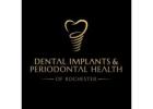 Dental Implants & Periodontal Health