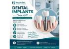Trusted Tooth Replacement Options with Dental Implants Camp Hill by Norman Park Dental Surgery