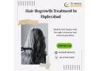 Hair Regrowth Treatment In Hyderabad | Dr. Venus