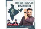 Hair transplant in Gurgaon