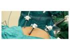 Dr. Ashish Vashistha – Expert Laparoscopic & Robotic Gallbladder Surgeon in Delhi