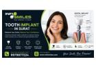 Advanced Tooth Implant in Surat for a Confident Smile