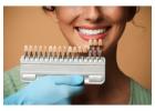Veneers in San Antonio, TX