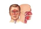 ENT Hospital Ahmedabad | Best ENT Specialists | Zydus Hospitals
