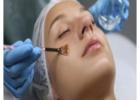 Best Chemical Peel in Kolkata for Clear Glowing Skin