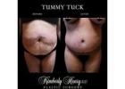 Plastic Surgery Today Greenbrae