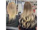 Discover Expert Hair Loss Solutions at Dallas