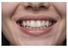 San Antonio Dentists
