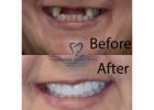 Dentist Near Me Lexington